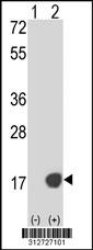 Western blot analysis of his-tag HIST1H2BD (arrow) using his tag antibody. 293 cell lysates (2 ug/lane) either nontransfected (Lane 207) or transiently transfected with theHIST1H2BD gene.