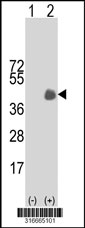 Western blot analysis of his-tag RPH3AL (arrow) using his tag antibody. 293T cell lysates (2 ug/lane) either nontransfected (Lane 1) or transiently transfected with the RPH3AL gene‘