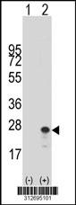 Western blot analysis of his-tag FFAR1 (arrow) using his tag antibody. 293 cell lysates (2 ug/lane) either nontransfected (Lane 1) or transiently transfected with the FFAR1 gene.