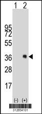 Western blot analysis of his-tag GPM6B (arrow) using his tag antibody. 293 cell lysates (2 ug/lane) either nontransfected (Lane 1) or transiently transfected with the GPM6B gene.