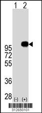 Western blot analysis of his-tag GP1BA (arrow) using his tag antibody. 293 cell lysates (2 ug/lane) either nontransfected (Lane 163) or transiently transfected with theGP1BA gene.