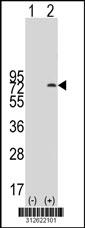 Western blot analysis of his-tag ETV5 (arrow) using his tag antibody. 293 cell lysates (2 ug/lane) either nontransfected (Lane 1) or transiently transfected with the ETV5 gene.