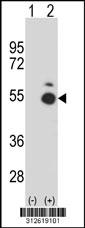 Western blot analysis of his-tag CFH (arrow) using his tag antibody. 293 cell lysates (2 ug/lane) either nontransfected (Lane 201) or transiently transfected with theCFH gene.