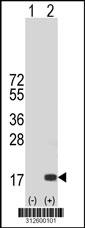 Western blot analysis of his-tag HBE1 (arrow) using his tag antibody. 293 cell lysates (2 ug/lane) either nontransfected (Lane 1) or transiently transfected with the HBE1 gene.