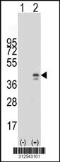 Western blot analysis of his-tag CTSL2 (arrow) using his tag antibody. 293 cell lysates (2 ug/lane) either nontransfected (Lane 1) or transiently transfected with the CTSL2 gene.