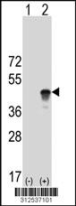 Western blot analysis of his-tag NKX2-5 (arrow) using his tag antibody. 293 cell lysates (2 ug/lane) either nontransfected (Lane 150) or transiently transfected with theNKX2-5 gene.