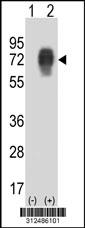 Western blot analysis of his-tag CSF2RA (arrow) using his tag antibody. 293 cell lysates (2 ug/lane) either nontransfected (Lane 206) or transiently transfected with theCSF2RA gene.