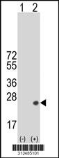 Western blot analysis of his-tag CSF2 (arrow) using his tag antibody. 293 cell lysates (2 ug/lane) either nontransfected (Lane 1) or transiently transfected with the CSF2 gene.