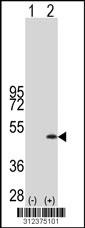 Western blot analysis of his-tag CES1 (arrow) using his tag antibody. 293 cell lysates (2 ug/lane) either nontransfected (Lane 93) or transiently transfected with theCES1 gene.