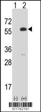 Western blot analysis of his-tag PCCB (arrow) using his tag antibody. 293 cell lysates (2 ug/lane) either nontransfected (Lane 104) or transiently transfected with thePCCB gene.