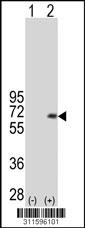 Western blot analysis of his-tag PRKAA1 (arrow) using his tag antibody. 293 cell lysates (2 ug/lane) either nontransfected (Lane 204) or transiently transfected with thePRKAA1 gene.