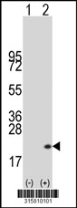 Western blot analysis of his-tag SLPI (arrow) using his tag antibody. 293T cell lysates (2 ug/lane) either nontransfected (Lane 1) or transiently transfected with the SLPI gene‘