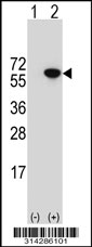 Western blot analysis of his-tag GRB7 (arrow) using his tag antibody. 293 cell lysates (2 ug/lane) either nontransfected (Lane 1) or transiently transfected with the GRB7 gene.