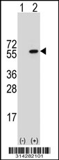 Western blot analysis of his-tag COPS2 (arrow) using his tag antibody. 293 cell lysates (2 ug/lane) either nontransfected (Lane 1) or transiently transfected with the COPS2 gene.