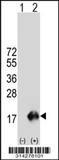 Western blot analysis of his-tag TNFRSF12A (arrow) using his tag antibody. 293 cell lysates (2 ug/lane) either nontransfected (Lane 1) or transiently transfected with the TNFRSF12A gene.