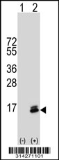 Western blot analysis of his-tag ATP5S (arrow) using his tag antibody. 293 cell lysates (2 ug/lane) either nontransfected (Lane 1) or transiently transfected with the ATP5S gene.