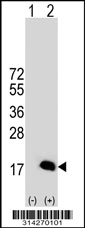 Western blot analysis of his-tag LIMD2 (arrow) using his tag antibody. 293 cell lysates (2 ug/lane) either nontransfected (Lane 1) or transiently transfected with the LIMD2 gene.