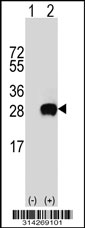 Western blot analysis of his-tag PRPF38A (arrow) using his tag antibody. 293 cell lysates (2 ug/lane) either nontransfected (Lane 1) or transiently transfected with the PRPF38A gene.