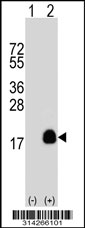Western blot analysis of his-tag WFDC5 (arrow) using his tag antibody. 293 cell lysates (2 ug/lane) either nontransfected (Lane 1) or transiently transfected with the WFDC5 gene.