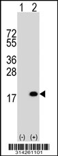 Western blot analysis of his-tag C19orf25 (arrow) using his tag antibody. 293 cell lysates (2 ug/lane) either nontransfected (Lane 1) or transiently transfected with the C19orf25 gene.