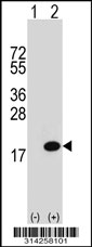 Western blot analysis of his-tag ATP6V1G1 (arrow) using his tag antibody. 293 cell lysates (2 ug/lane) either nontransfected (Lane 1) or transiently transfected with the ATP6V1G1 gene.