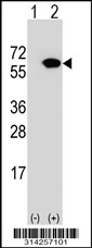 Western blot analysis of his-tag NVL (arrow) using his tag antibody. 293 cell lysates (2 ug/lane) either nontransfected (Lane 1) or transiently transfected with the NVL gene.