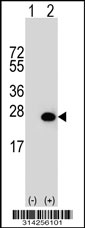 Western blot analysis of his-tag PRR13 (arrow) using his tag antibody. 293 cell lysates (2 ug/lane) either nontransfected (Lane 1) or transiently transfected with the PRR13 gene.