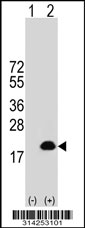 Western blot analysis of his-tag UBE2V2 (arrow) using his tag antibody. 293 cell lysates (2 ug/lane) either nontransfected (Lane 1) or transiently transfected with the UBE2V2 gene.