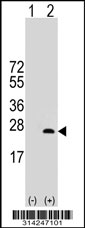 Western blot analysis of his-tag EIF1AY (arrow) using his tag antibody. 293 cell lysates (2 ug/lane) either nontransfected (Lane 1) or transiently transfected with the EIF1AY gene.