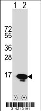 Western blot analysis of his-tag HRSP12 (arrow) using his tag antibody. 293 cell lysates (2 ug/lane) either nontransfected (Lane 1) or transiently transfected with the HRSP12 gene.