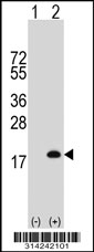 Western blot analysis of his-tag PFN2 (arrow) using his tag antibody. 293 cell lysates (2 ug/lane) either nontransfected (Lane 1) or transiently transfected with the PFN2 gene.