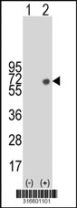 Western blot analysis of his-tag RTN4RL1 (arrow) using his tag antibody. 293T cell lysates (2 ug/lane) either nontransfected (Lane 1) or transiently transfected with the RTN4RL1 gene‘