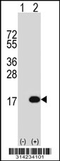 Western blot analysis of his-tag PHF5A (arrow) using his tag antibody. 293 cell lysates (2 ug/lane) either nontransfected (Lane 1) or transiently transfected with the PHF5A gene.