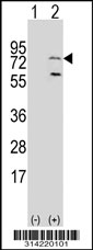 Western blot analysis of his-tag HSD17B4 (arrow) using his tag antibody. 293 cell lysates (2 ug/lane) either nontransfected (Lane 1) or transiently transfected with the HSD17B4 gene.