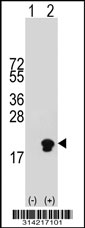 Western blot analysis of his-tag NGFRAP1 (arrow) using his tag antibody. 293 cell lysates (2 ug/lane) either nontransfected (Lane 1) or transiently transfected with the NGFRAP1 gene.
