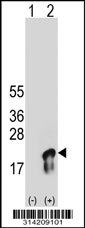 Western blot analysis of his-tag VAMP3 (arrow) using his tag antibody. 293 cell lysates (2 ug/lane) either nontransfected (Lane 1) or transiently transfected with the VAMP3 gene.
