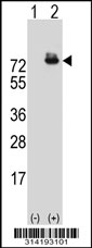 Western blot analysis of his-tag KLC2 (arrow) using his tag antibody. 293 cell lysates (2 ug/lane) either nontransfected (Lane 1) or transiently transfected with the KLC2 gene.