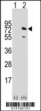 Western blot analysis of his-tag KIAA1279 (arrow) using his tag antibody. 293 cell lysates (2 ug/lane) either nontransfected (Lane 1) or transiently transfected with the KIAA1279 gene.