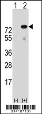 Western blot analysis of his-tag EZR (arrow) using his tag antibody. 293 cell lysates (2 ug/lane) either nontransfected (Lane 1) or transiently transfected with the EZR gene.