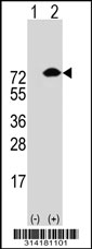 Western blot analysis of his-tag TRIP10 (arrow) using his tag antibody. 293 cell lysates (2 ug/lane) either nontransfected (Lane 1) or transiently transfected with the TRIP10 gene.
