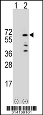 Western blot analysis of his-tag THRA (arrow) using his tag antibody. 293 cell lysates (2 ug/lane) either nontransfected (Lane 1) or transiently transfected with the THRA gene.