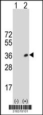 Western blot analysis of his-tag CHRFAM7A (arrow) using his tag antibody. 293T cell lysates (2 ug/lane) either nontransfected (Lane 1) or transiently transfected with the CHRFAM7A gene‘