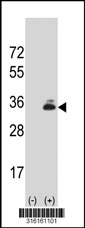 Western blot analysis of his-tag VSTM2A (arrow) using his tag antibody. 293T cell lysates (2 ug/lane) either nontransfected (Lane 1) or transiently transfected with the VSTM2A gene‘