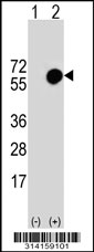 Western blot analysis of his-tag TUBG1 (arrow) using his tag antibody. 293 cell lysates (2 ug/lane) either nontransfected (Lane 1) or transiently transfected with the TUBG1 gene.