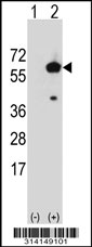 Western blot analysis of his-tag TMPRSS4 (arrow) using his tag antibody. 293 cell lysates (2 ug/lane) either nontransfected (Lane 1) or transiently transfected with the TMPRSS4 gene.