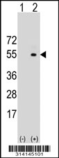 Western blot analysis of his-tag PSMC2 (arrow) using his tag antibody. 293 cell lysates (2 ug/lane) either nontransfected (Lane 1) or transiently transfected with the PSMC2 gene.