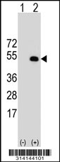 Western blot analysis of his-tag RUSC1 (arrow) using his tag antibody. 293 cell lysates (2 ug/lane) either nontransfected (Lane 1) or transiently transfected with the RUSC1 gene.