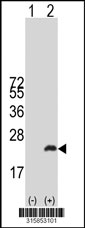 Western blot analysis of his-tag NUDT1 (arrow) using his tag antibody. 293T cell lysates (2 ug/lane) either nontransfected (Lane 1) or transiently transfected with the NUDT1 gene‘