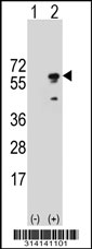 Western blot analysis of his-tag ECSIT (arrow) using his tag antibody. 293 cell lysates (2 ug/lane) either nontransfected (Lane 1) or transiently transfected with the ECSIT gene.