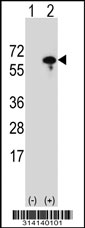 Western blot analysis of his-tag DBNL (arrow) using his tag antibody. 293 cell lysates (2 ug/lane) either nontransfected (Lane 1) or transiently transfected with the DBNL gene.